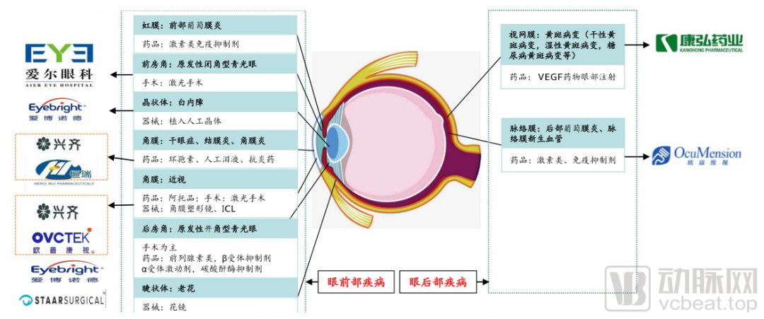 1年融资超80亿，4家IPO，狂奔的眼科还能更火吗？